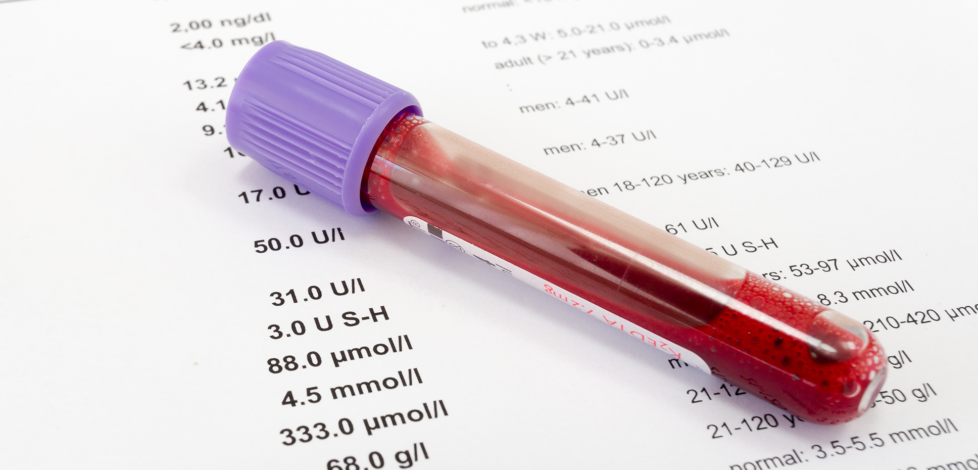 Mitigating Mortality Slippage of Preferred Classification in Non-fluid ...