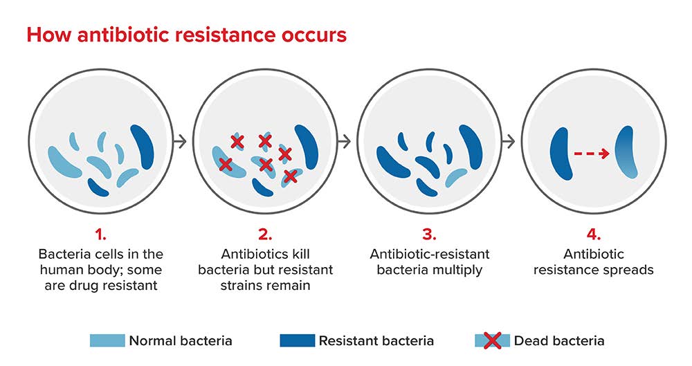 Antimicrobial Resistance (AMR) | RGA